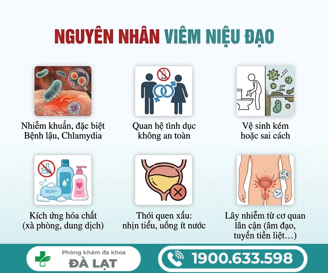 Hình ảnh minh họa